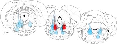 From molecule to oblivion: dedicated brain circuitry underlies anesthetic loss of consciousness permitting pain-free surgery